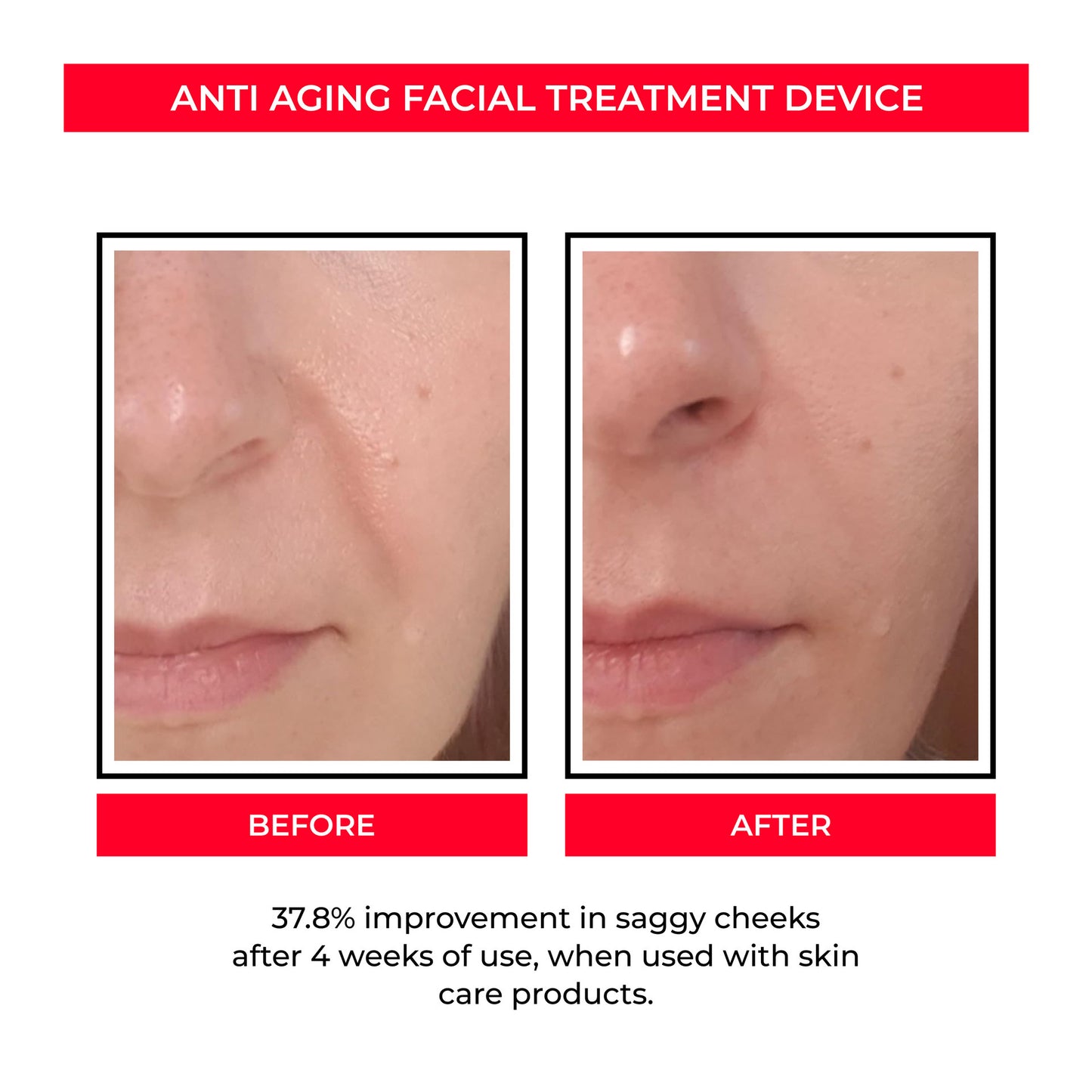 GlowLift™ EMS Microcurrent Facial Device – Skin Rejuvenation & Anti-Aging Toning Tool