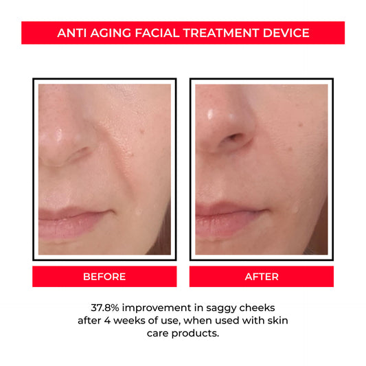 GlowLift™ EMS Microcurrent Facial Device – Skin Rejuvenation & Anti-Aging Toning Tool